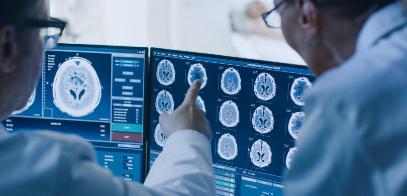 Two doctors looking at computer monitors with brain scans on screenss